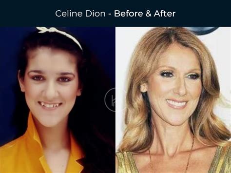 celine dion fake teeth|celine dion boyfriend.